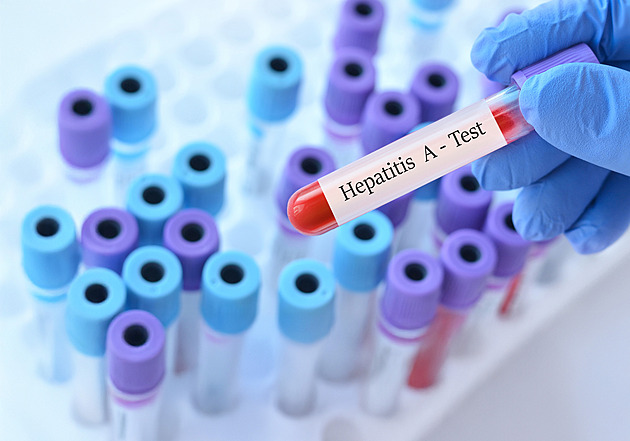 Obavy u sousedů. Německo kvůli žloutence vydalo doporučení pro cesty do Česka